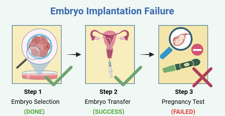 Implantation Failure Treatment