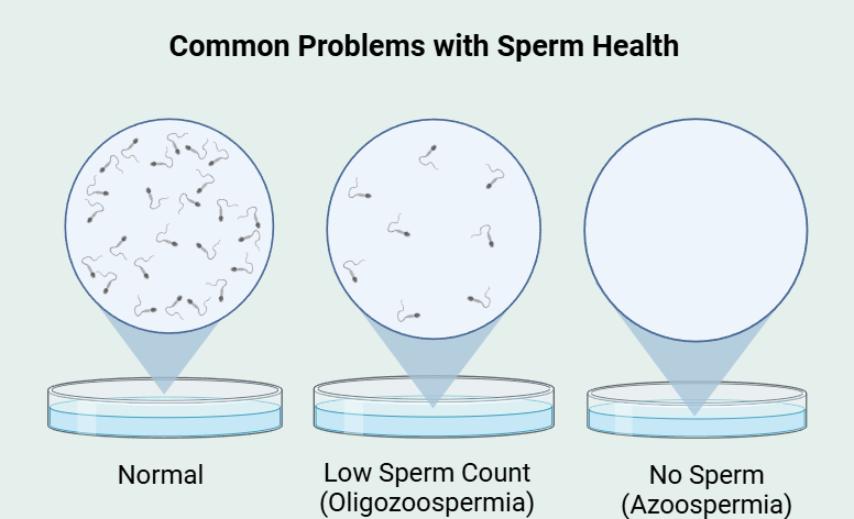 Most-common-infertility-conditions-in-men-AFIC